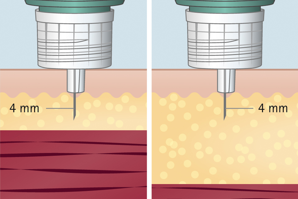 Short pen needles - suitable for everyone