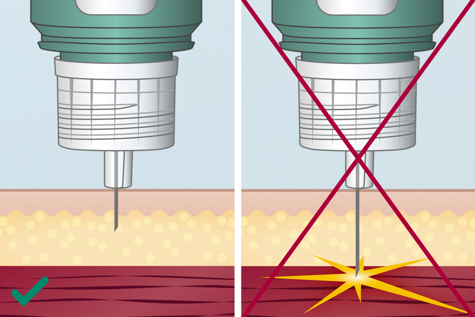 Inject Insulin With Steady Shot For Diabetes Pen Needles