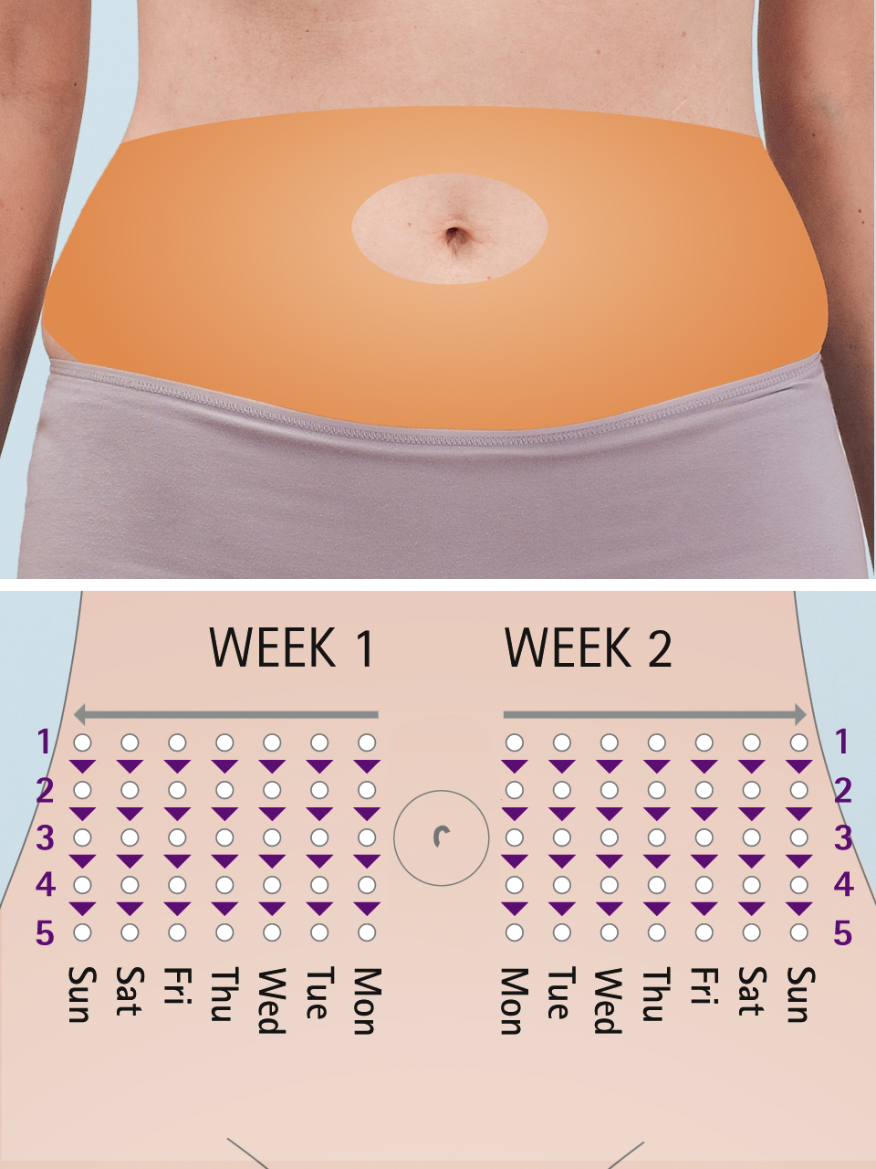 Site rotation - abdomen