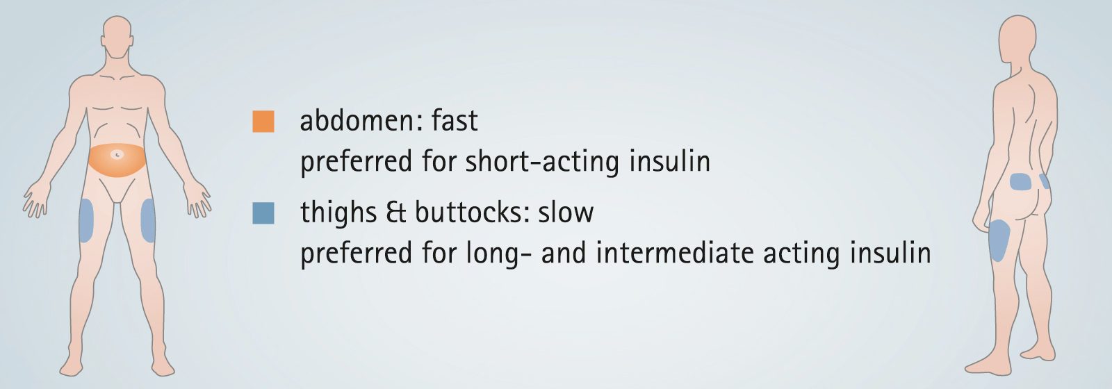 Insulin types and injection areas
