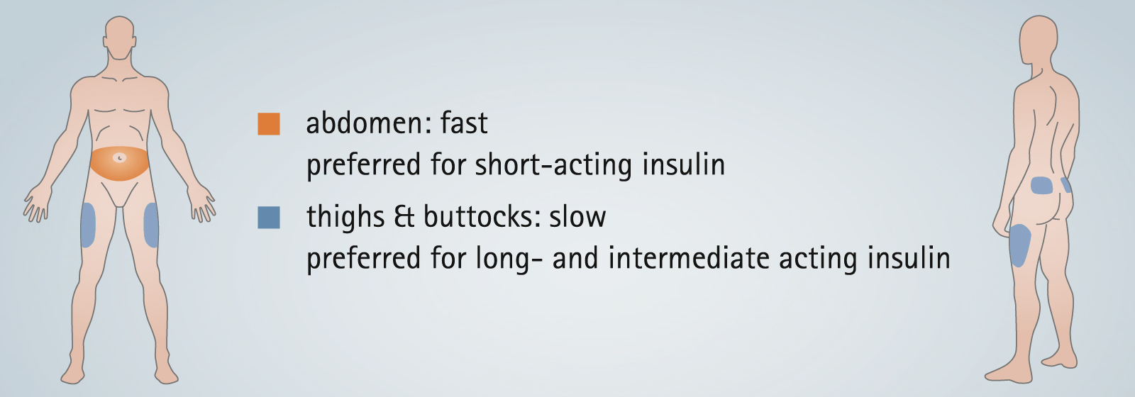 Insulin types and injection areas