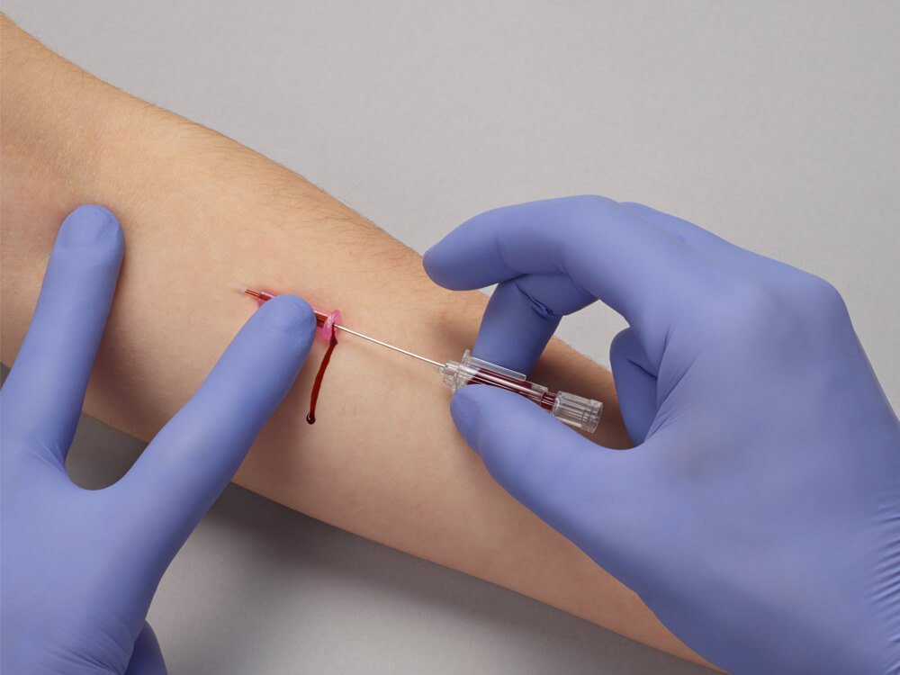 Peripheral Intravenous Catheters PIVC Access Is Key To Care B Braun Peripheral Intravenous Catheters PIVC Access Is Key To Care B Braun